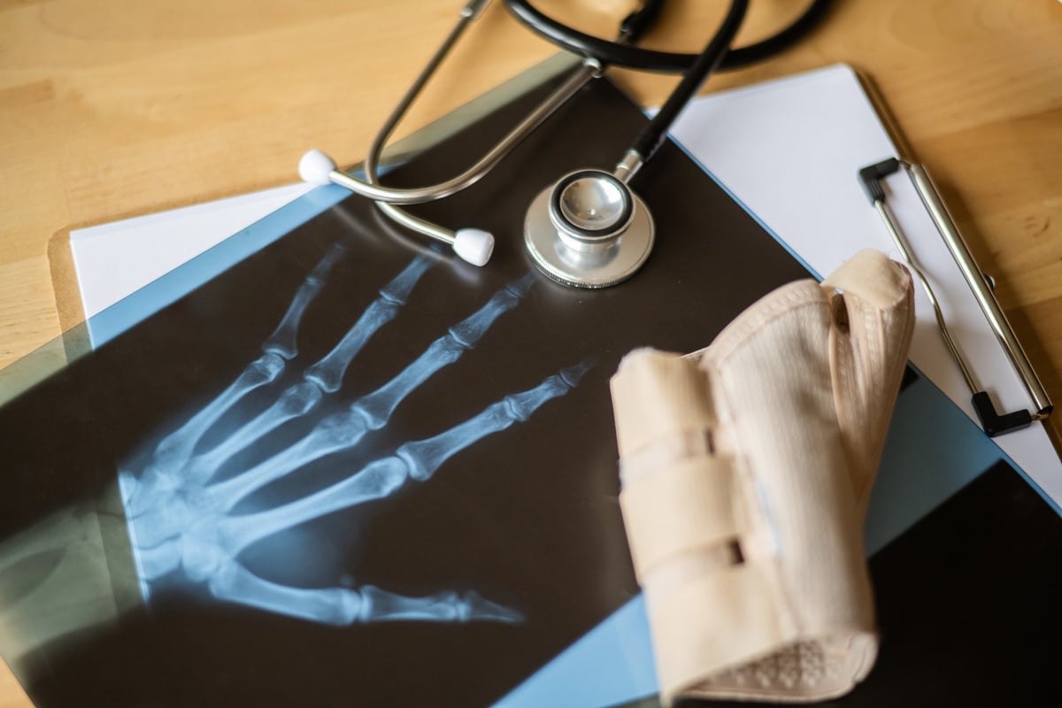 Orthopedic physician reviewing a hand and wrist X-ray to evaluate a fracture